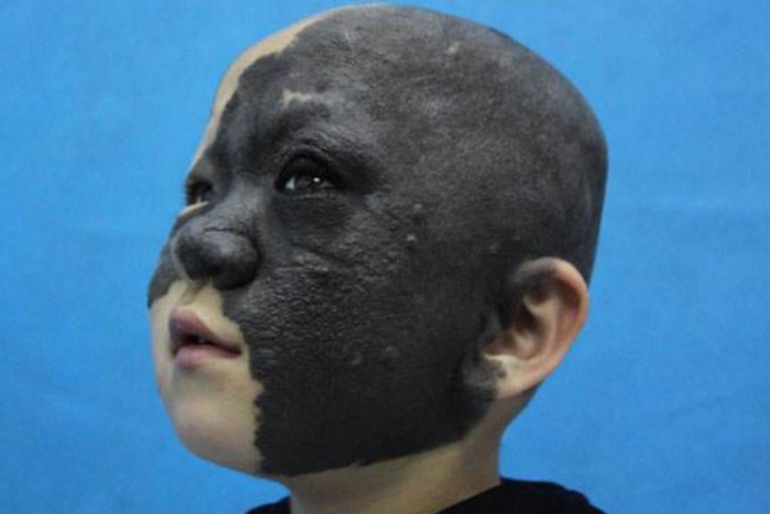 福建孕妇生下黑宝宝,福建孕妇生下熊猫宝宝抖音