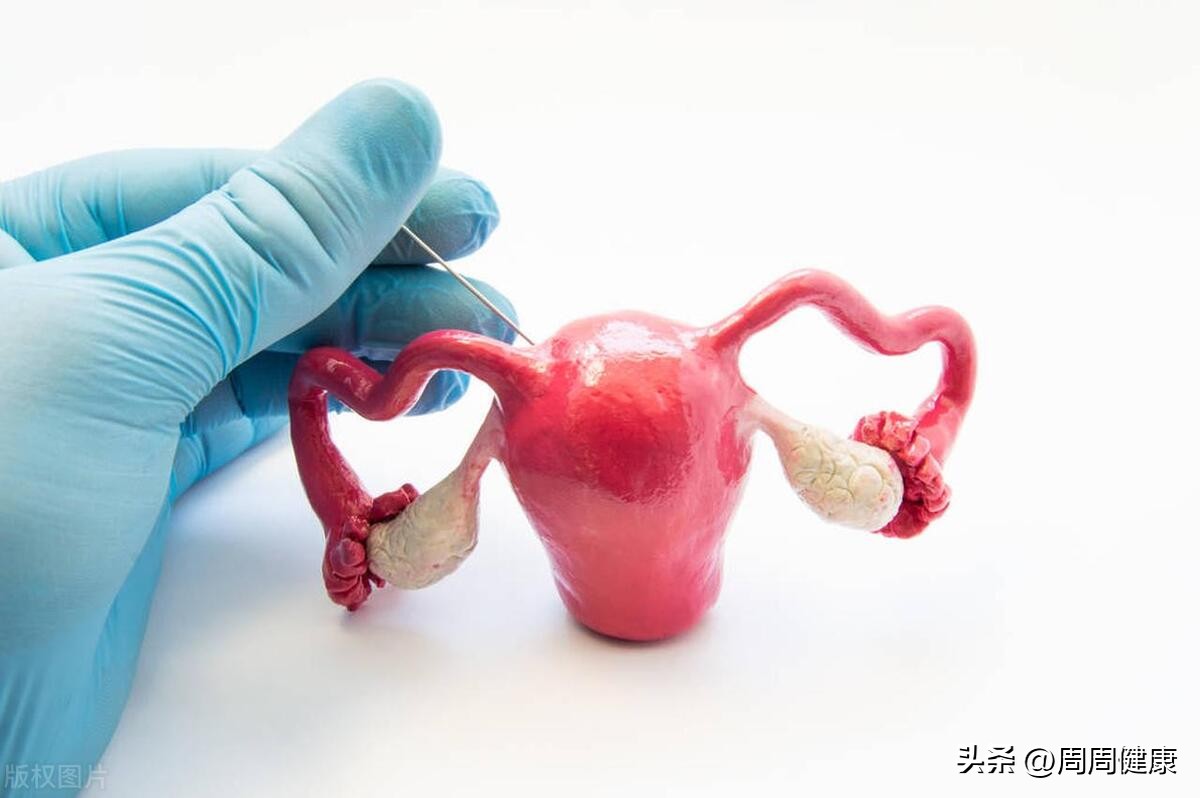 盆腔炎症状及治疗方案,盆腔炎症状需要注意什么