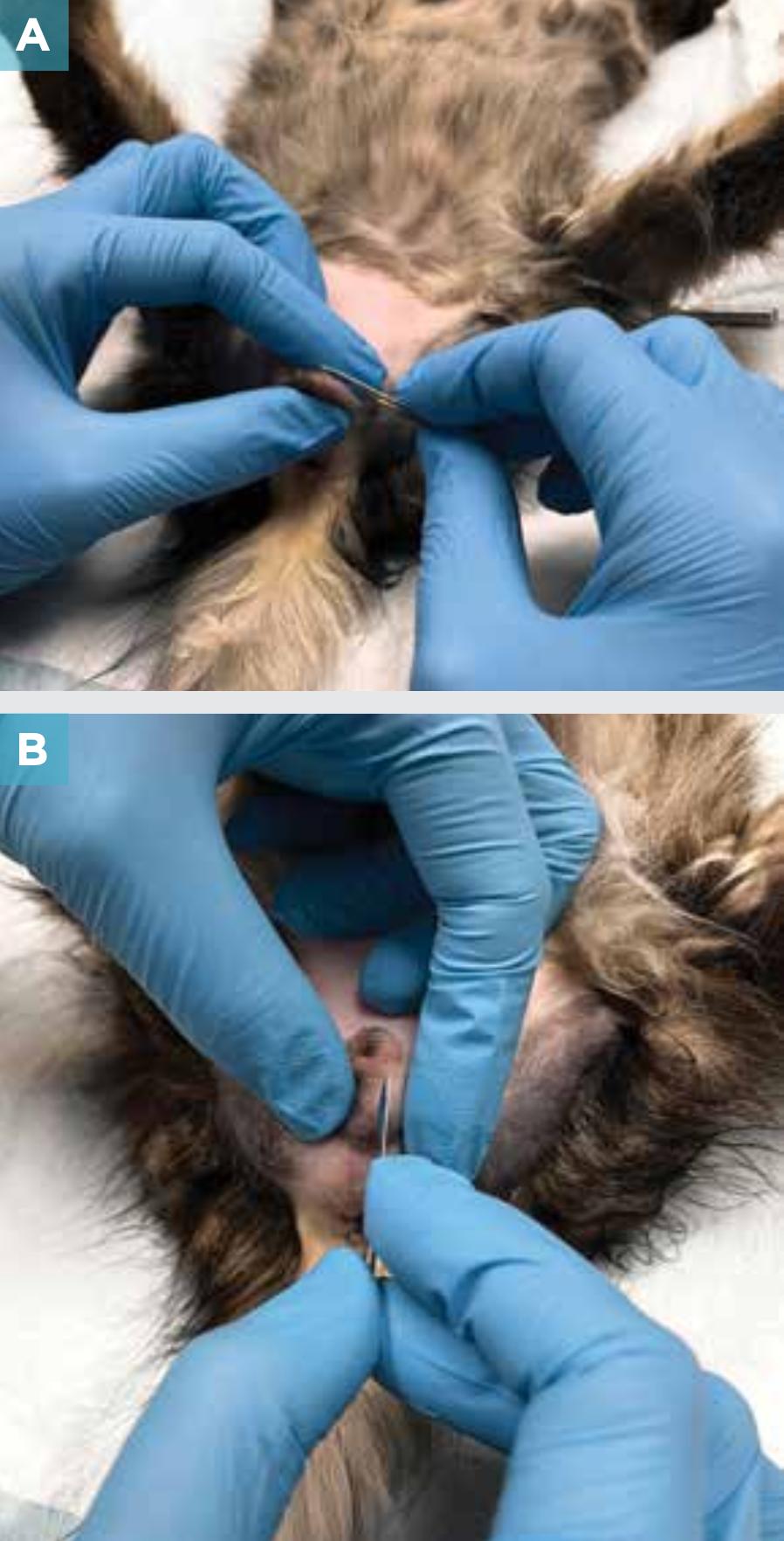 附睾炎切除术多少钱,附睾炎微创手术治疗全过程