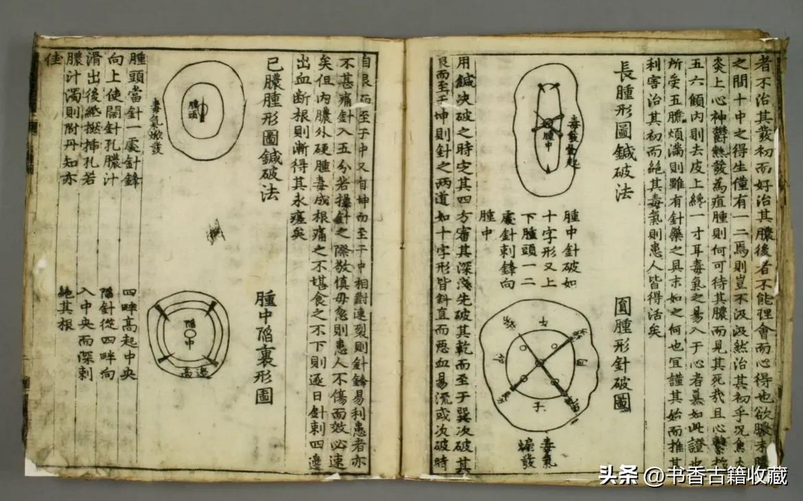 【中医秘本】《治肿指南》