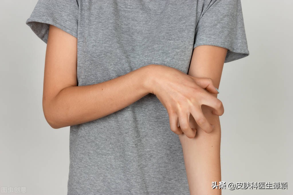 皮肤科医生怎么样确诊疥疮,皮肤科医生谈预防蚊虫