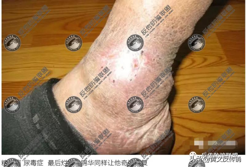 锦华食用菌的危害,锦华食用菌保健品骗局