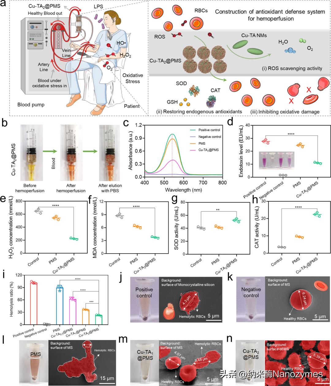 工程抗氧化级联金属酚醛纳米酶缓解体外血液净化过程中的氧化应激