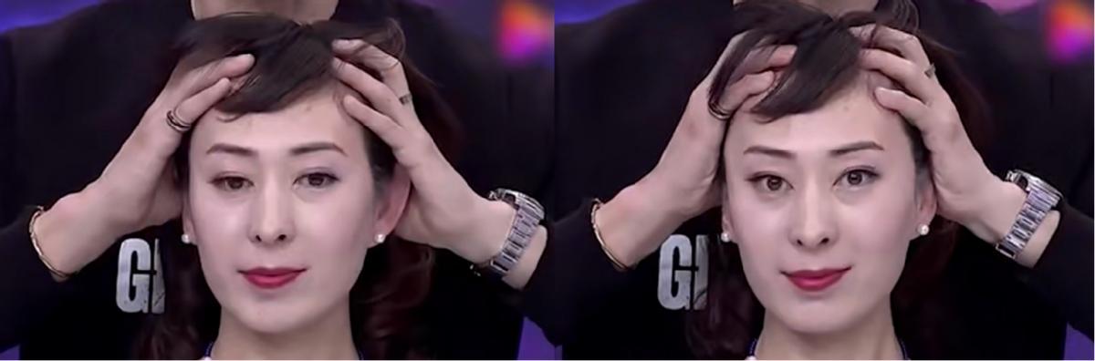 头皮松弛是衰老的前兆吗,头皮有紧箍感且越来越松弛