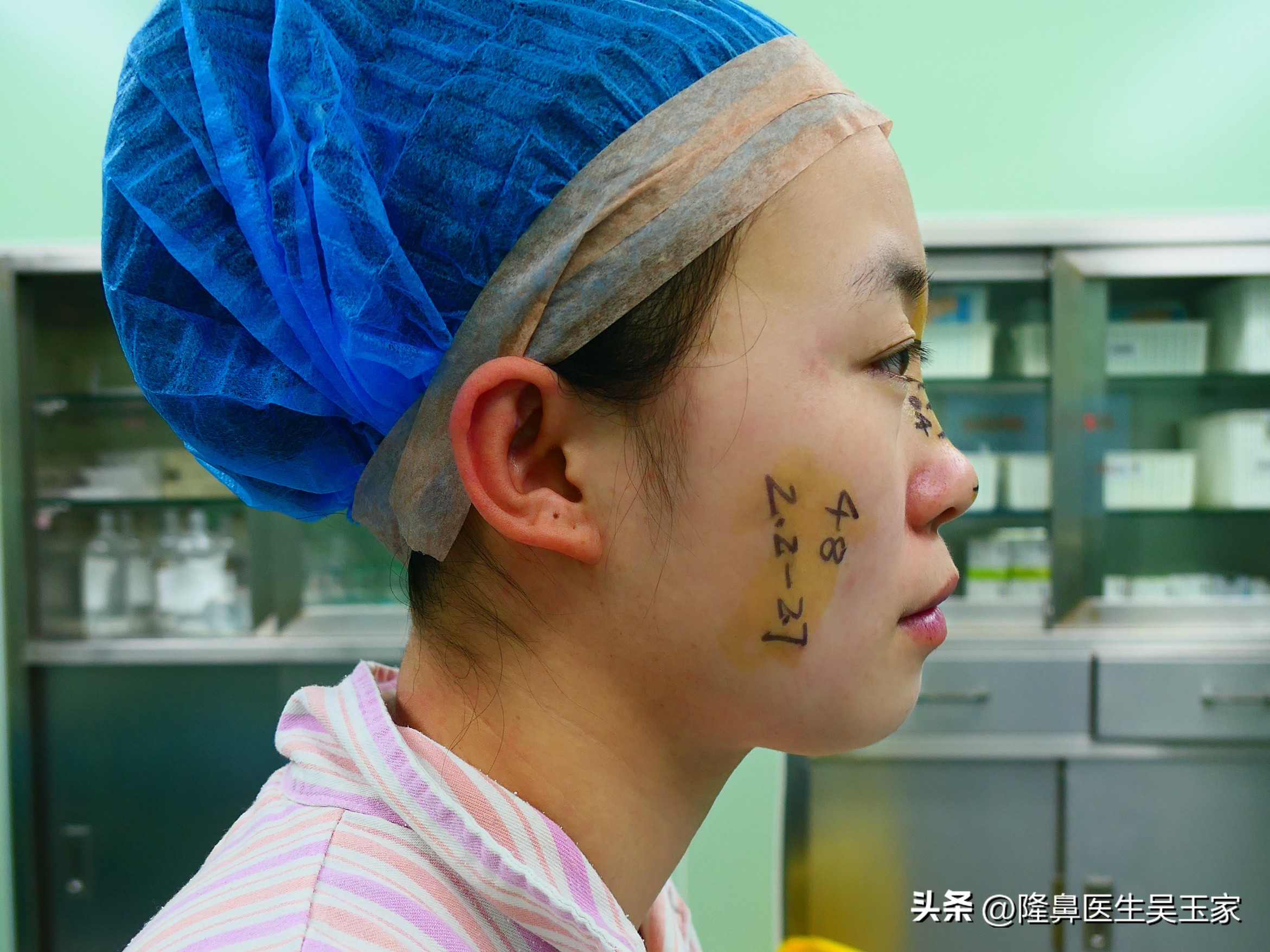 天津28岁姑娘动手术,29岁女子瞒着家人整容