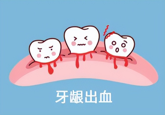 儿童电动牙刷优缺点,电动牙刷优缺点