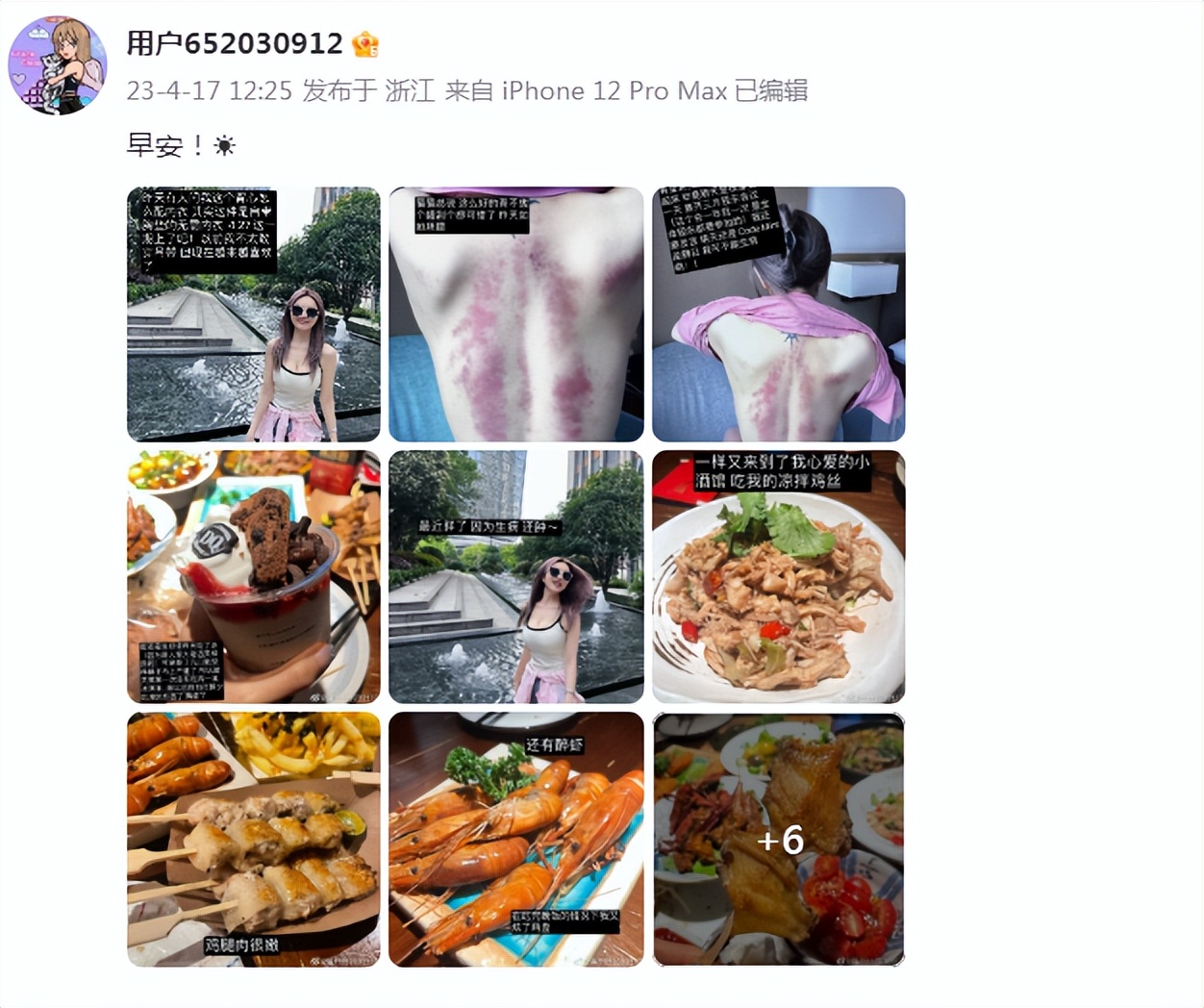 周扬青晒100斤身材,周扬青脸部消肿