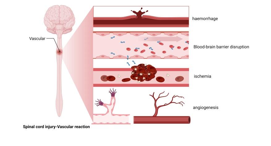 脊髓损伤治疗研究最新进展,首都医科大学脊髓损伤治疗
