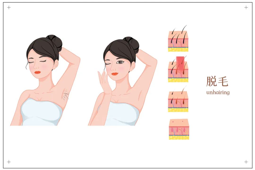 哪种脱毛方法永久脱毛不会再长毛,脱毛小妙招不伤皮