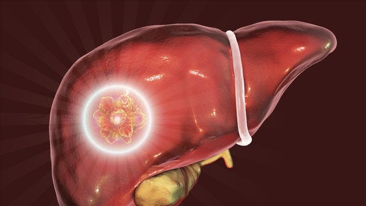 谷丙转氨酶高怎么回事是什么病,谷丙转氨酶高怎么回事严重吗