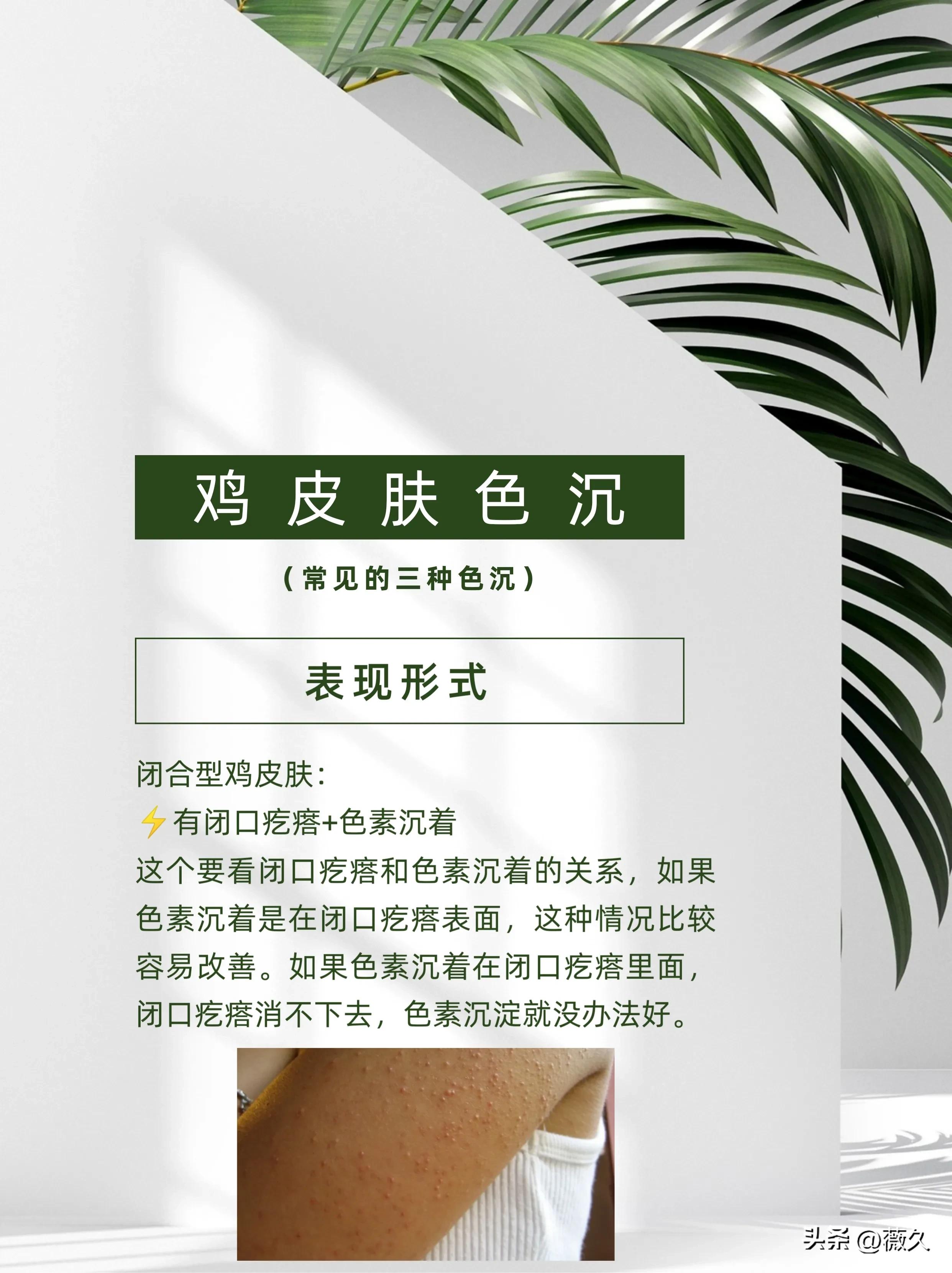 鸡皮肤必读!诱发因素+改善方法合集!