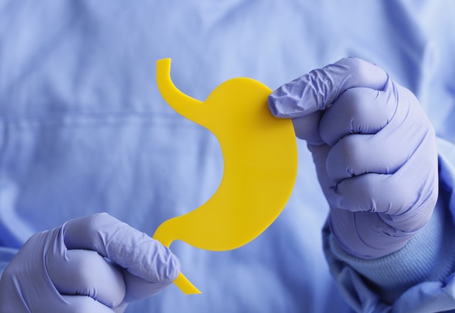 医生科普食管腺癌的发病原因,腺癌是什么原因引起的