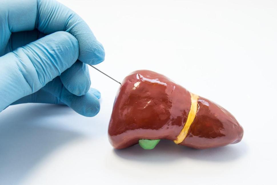 经常喝酒的人身体有什么表现,长期喝酒会得酒精肝吗