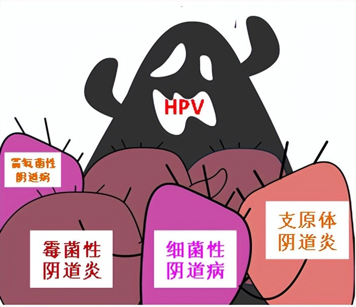 【掌健识】HPV感染和反复阴道炎有关吗