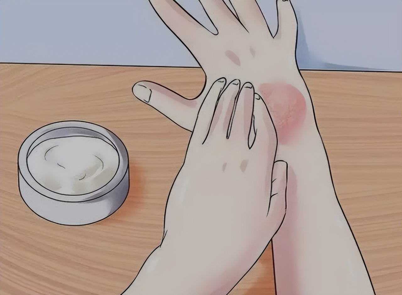 艾滋病潜伏期会单纯出现皮肤病吗,皮肤感染艾滋病多久会出现症状