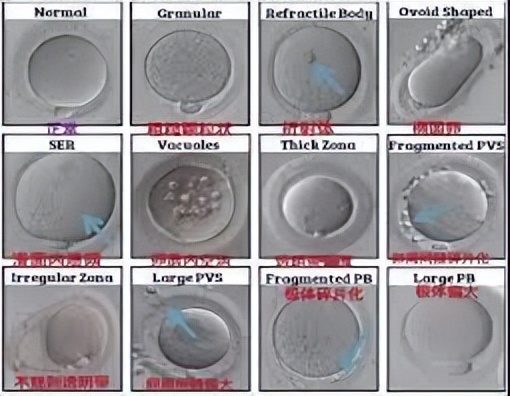 科学家发现精子和卵子,科学家首次拍到粒子和波相互转化