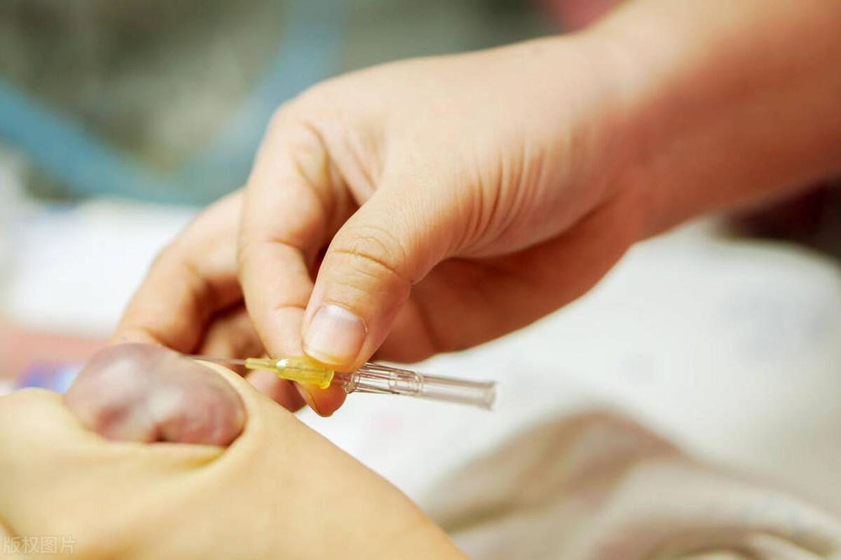 新生儿糖尿病怎么办,新生儿糖尿病预后怎样