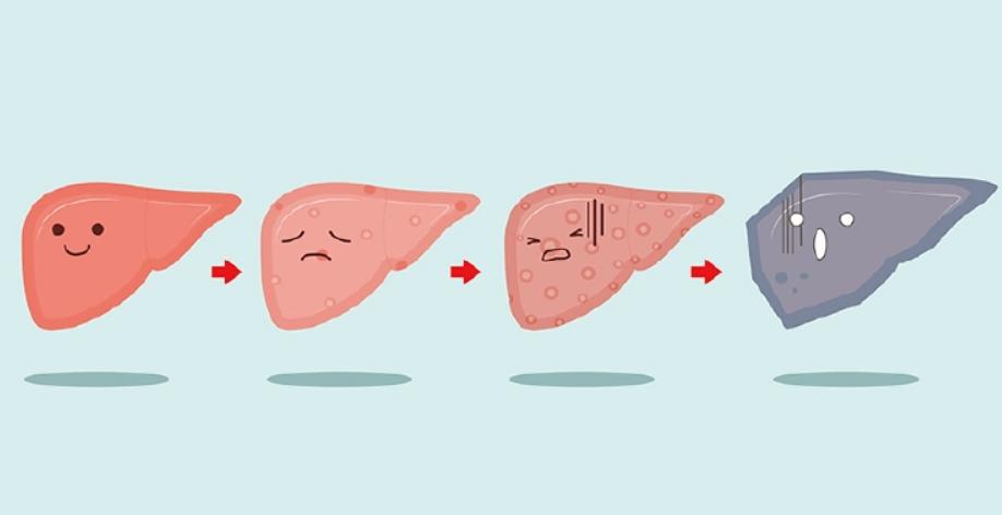 肝血亏虚会导致肝硬化吗,肝硬化了怎么养肝血