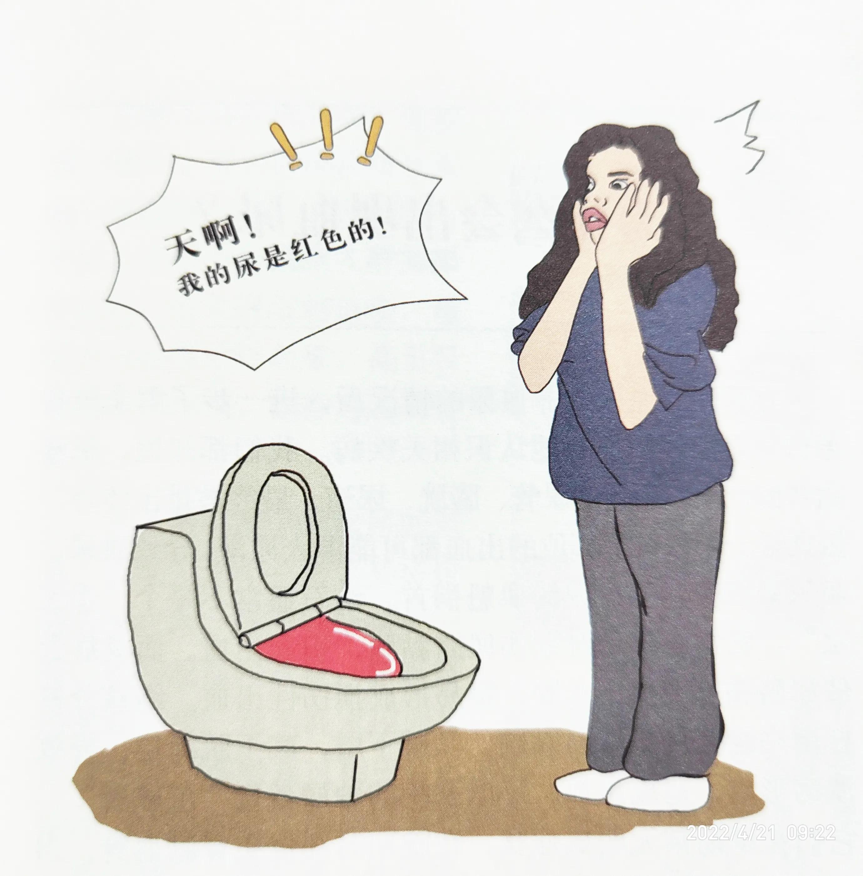 泌尿症状有哪些,泌尿症状