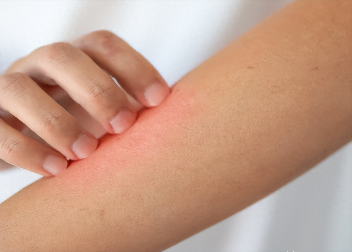 过敏洗澡能用沐浴露吗,为什么有人一洗澡就过敏