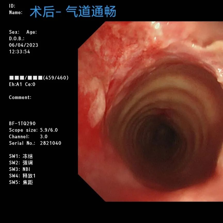 酒后呼吸困难急救,男子误喝消毒水心肺复苏