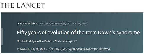 唐氏综合征的人相貌图片,唐氏综合征国字脸