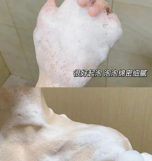 后背生疮是什么原因引起的,后背痤疮发痒怎么办