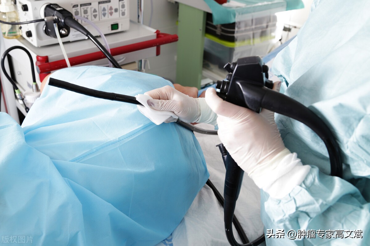 肠息肉切除后复查怎么办,肠息肉切除后怎样复查