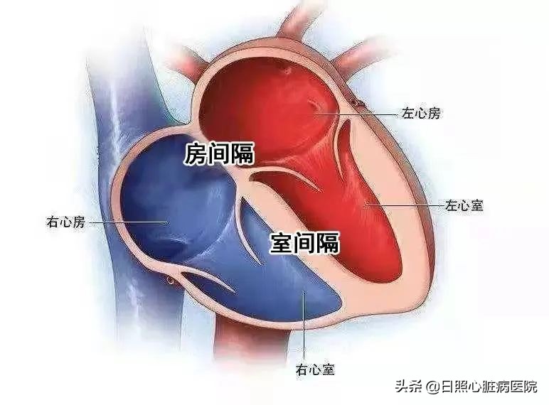 心脏室间隔缺损不治疗行吗,心脏有个洞要补吗