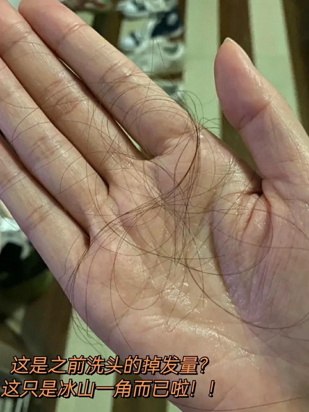 宝妈头发很多碎发和炸毛怎么养发,养发不炸毛不掉发怎么打理