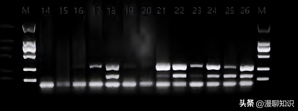猫会感染人的疾病的图片,猫病毒检测cpr可以测出什么病毒