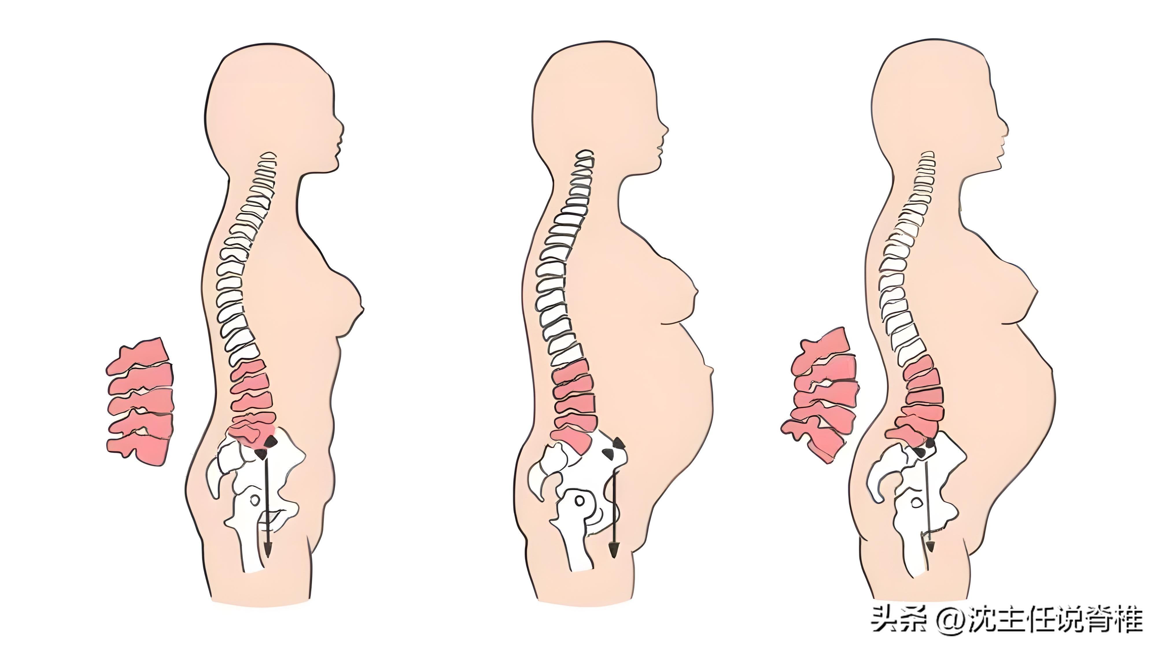 右上臀部靠近腰疼痛是什么原因,臀部右上方疼痛是什么原因引起的