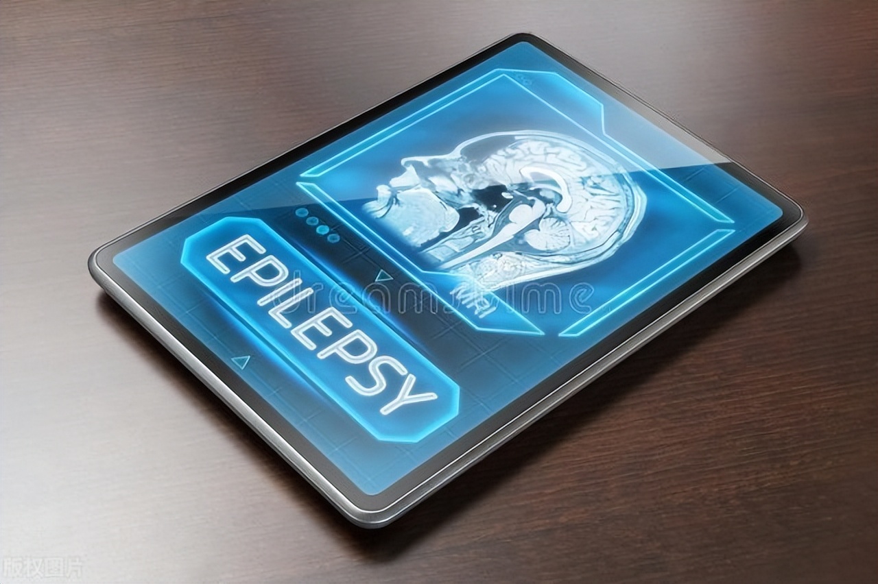 癫痫遗传注意事项,遗传代谢引起的癫痫哪些可以治愈