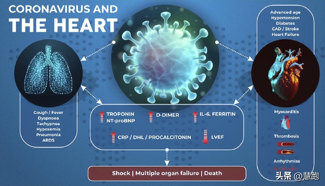 阳康后哪些运动算剧烈运动,阳康剧烈运动心肌炎能治好吗
