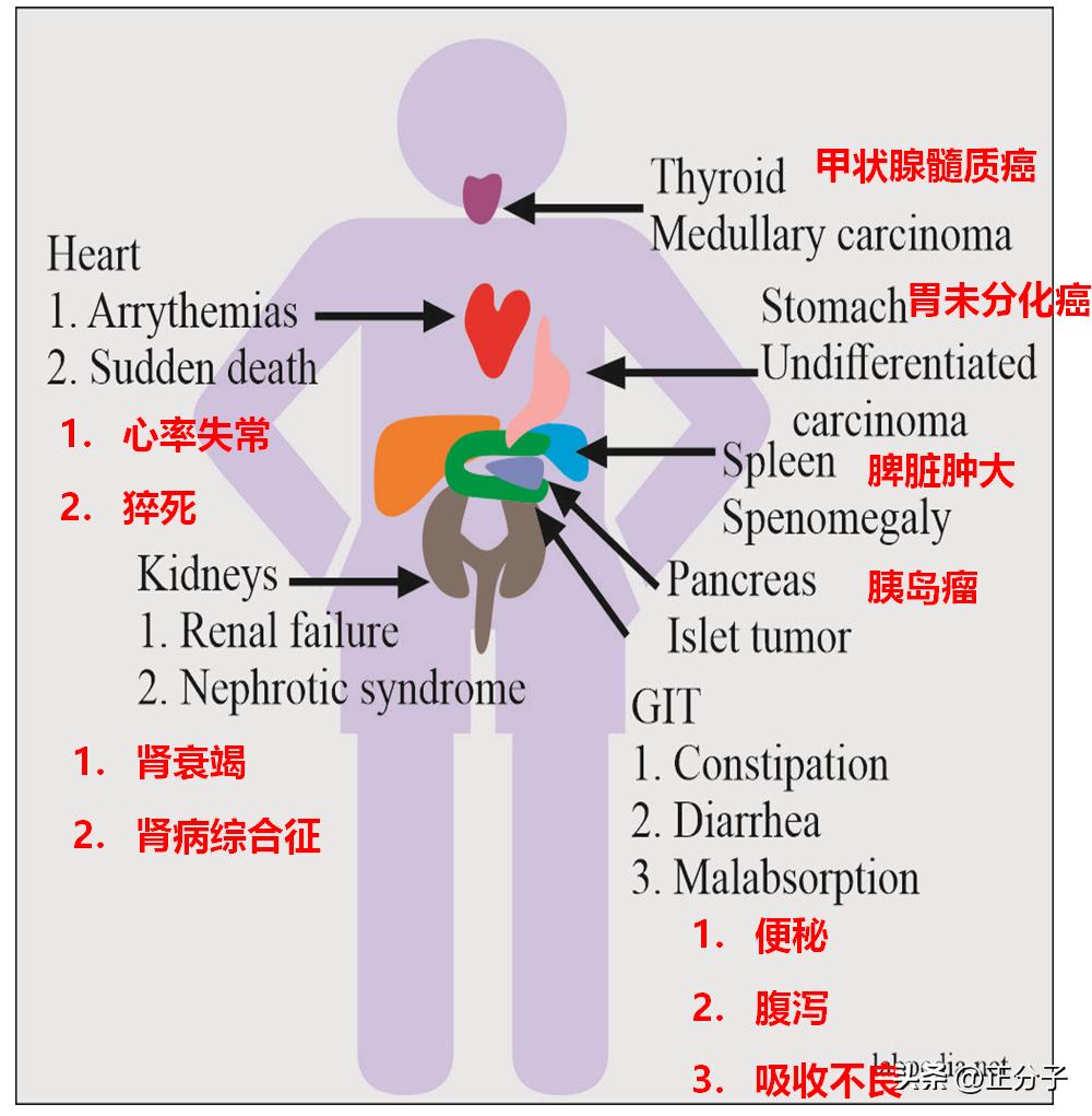 新冠引起间质性改变,新冠后遗症引起淀粉样变性