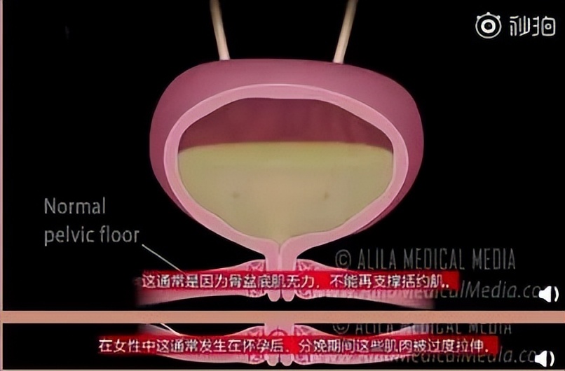 钟嘉欣怀孕几个月,钟嘉欣生三胎后迅速恢复状态