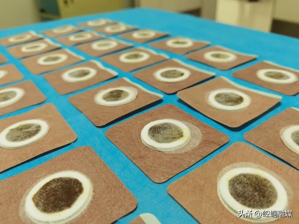 中医怎么治过敏性鼻炎流清涕不止,过敏性鼻炎眼睛痒的中医治疗方法