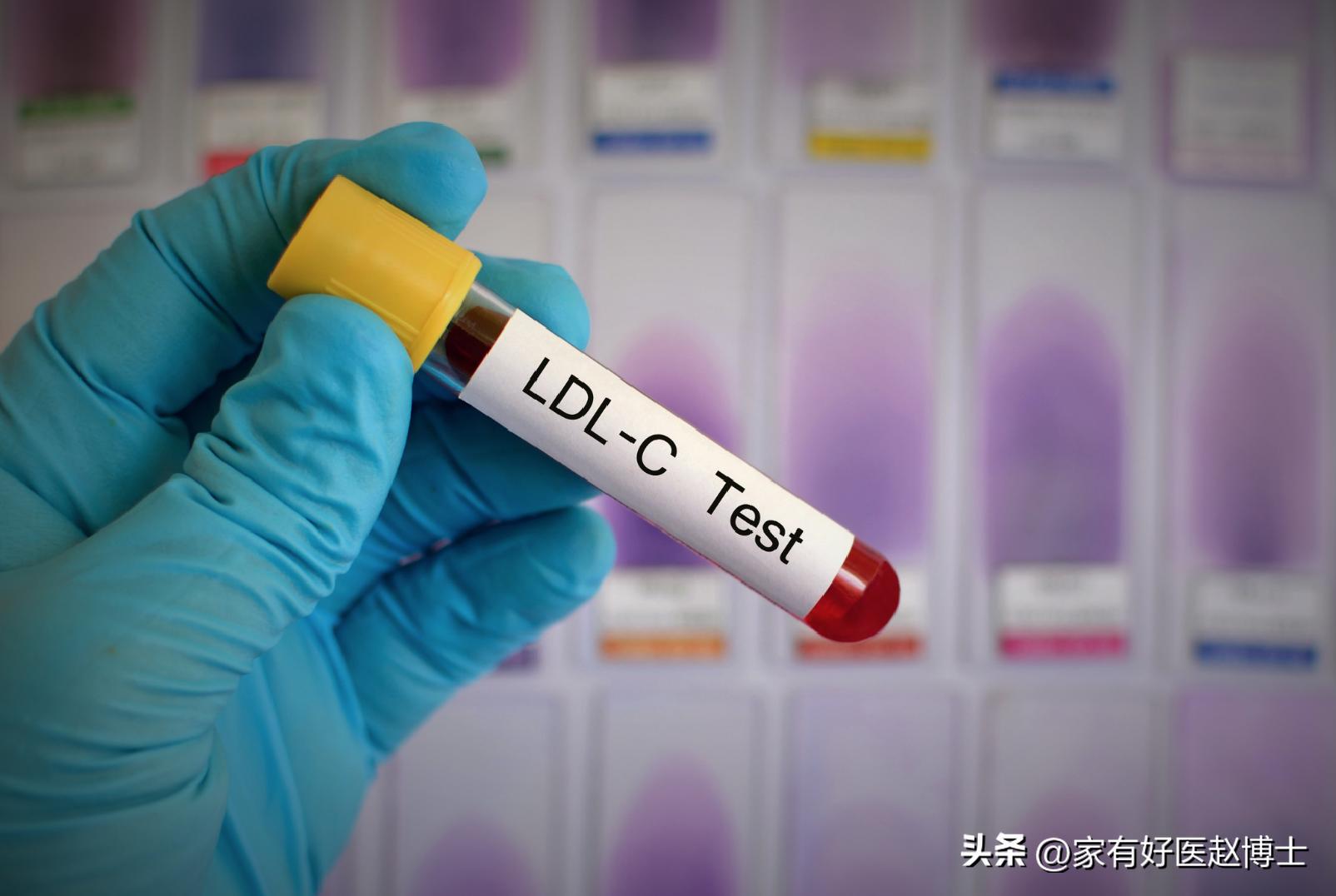 iwatch怎么预防心梗脑梗,张之瀛大夫如何预防心梗和脑梗