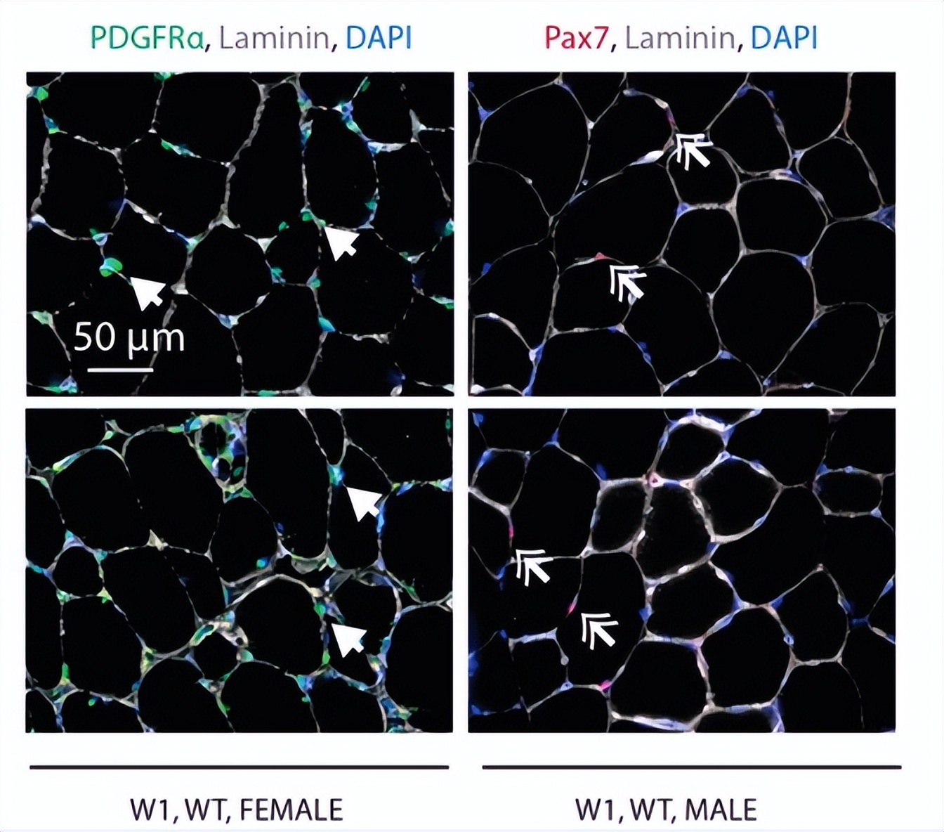 核因子,NFκB,在临床治疗上,是否与腱切断术的肌肉萎缩无关?