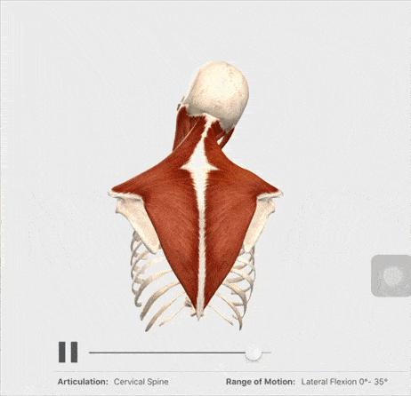 史上最严重的颈椎病,颈椎病到底有多可怕