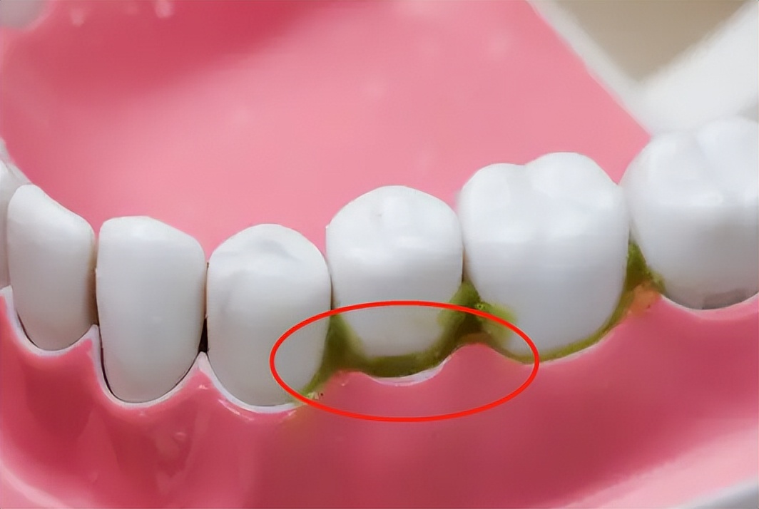 漱口水的禁忌有哪些,漱口水的十大禁忌