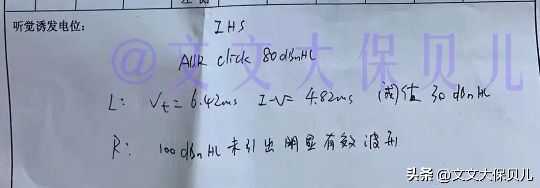 小儿右耳有点畸形测听力不正常,耳蜗发育畸形无听力能医疗吗