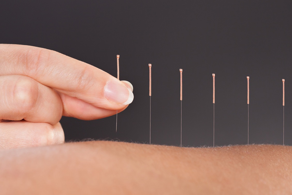 魏朝军三针治疗痛经针灸视频,推拿和针灸哪个治疗痛经效果好