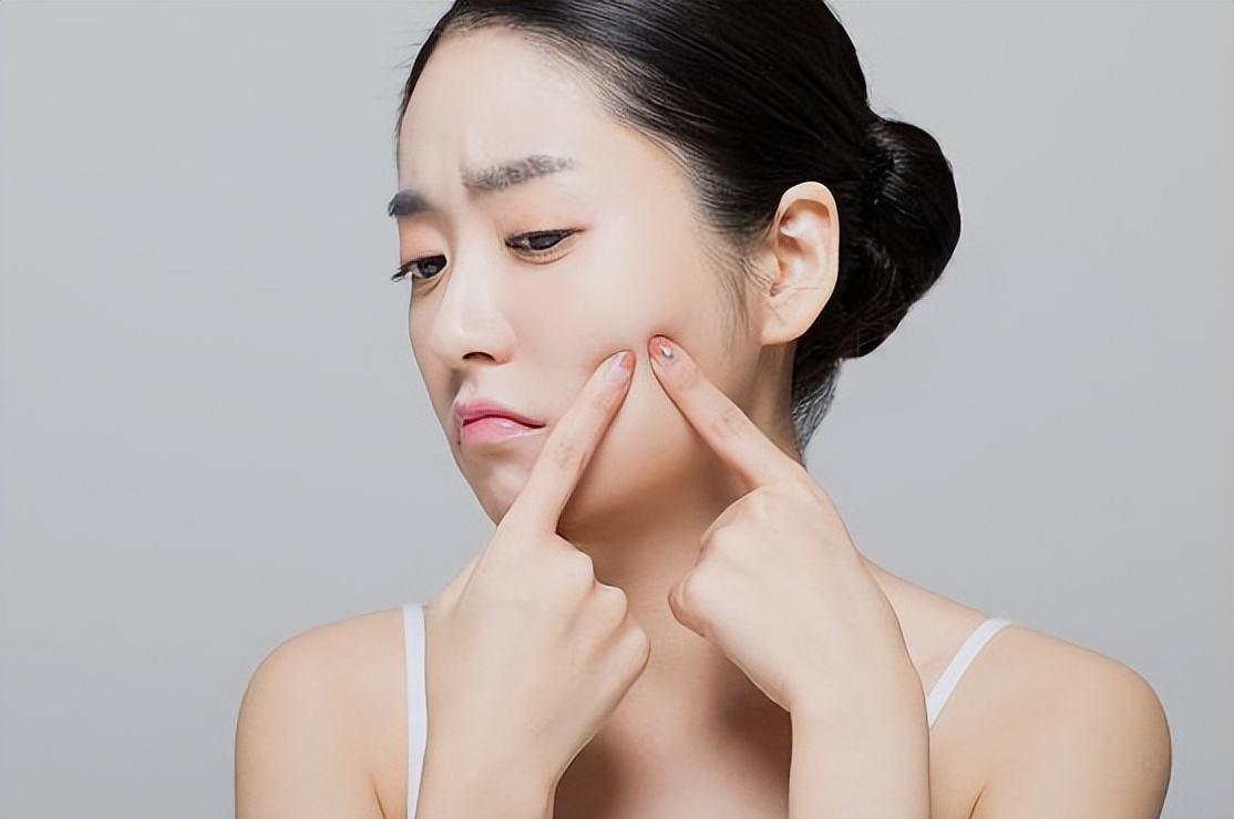 女生一来例假就长痘是什么原因,女生姨妈来了爆痘怎么办