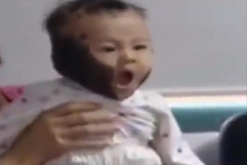 福建孕妇吃老鼠孩子长满黑斑,男子给怀孕的妻子吃竹鼠