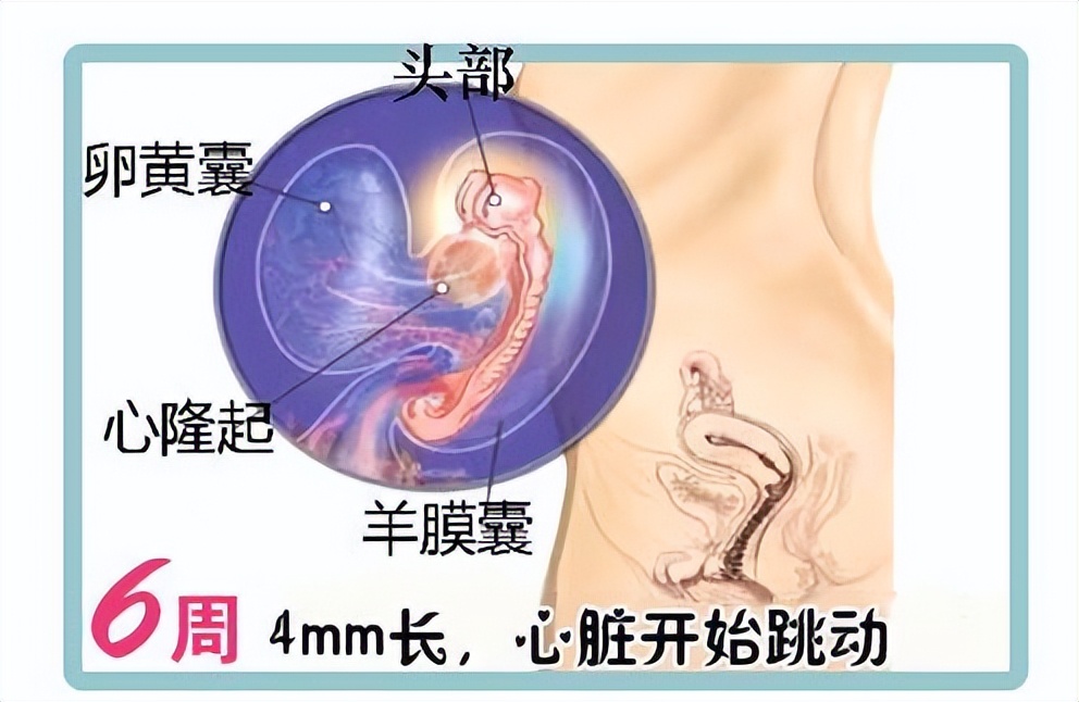 怀孕6个月胎儿图,6个月胎儿胎位横位要注意什么