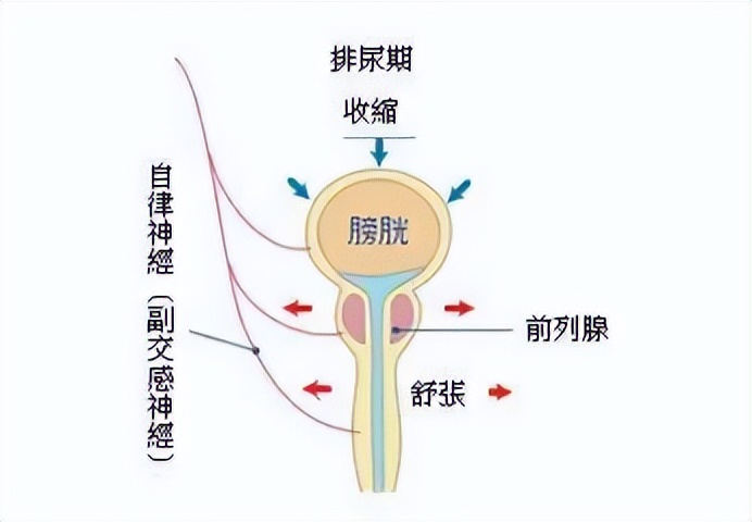 突然排不出尿,突然出现的尿潴留怎么办