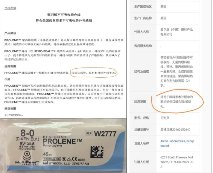 同济大学附属上海东方医院金海鹰教授：巩膜层间缝纫机技术要点