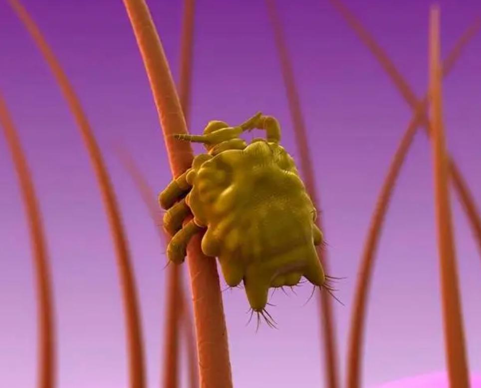 把阴虱用镊子找出来可以吗,阴虱是怎么通过性传播的