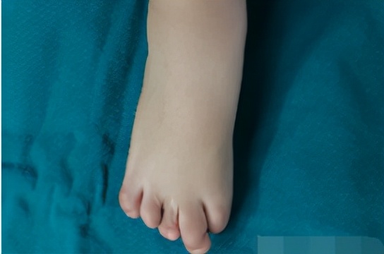 盘点西北妇儿硬核技术！是这些让我们面对疾病不再畏惧